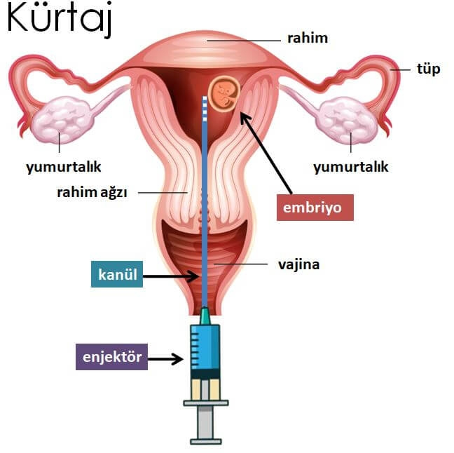 Kürtaj Fiyatları